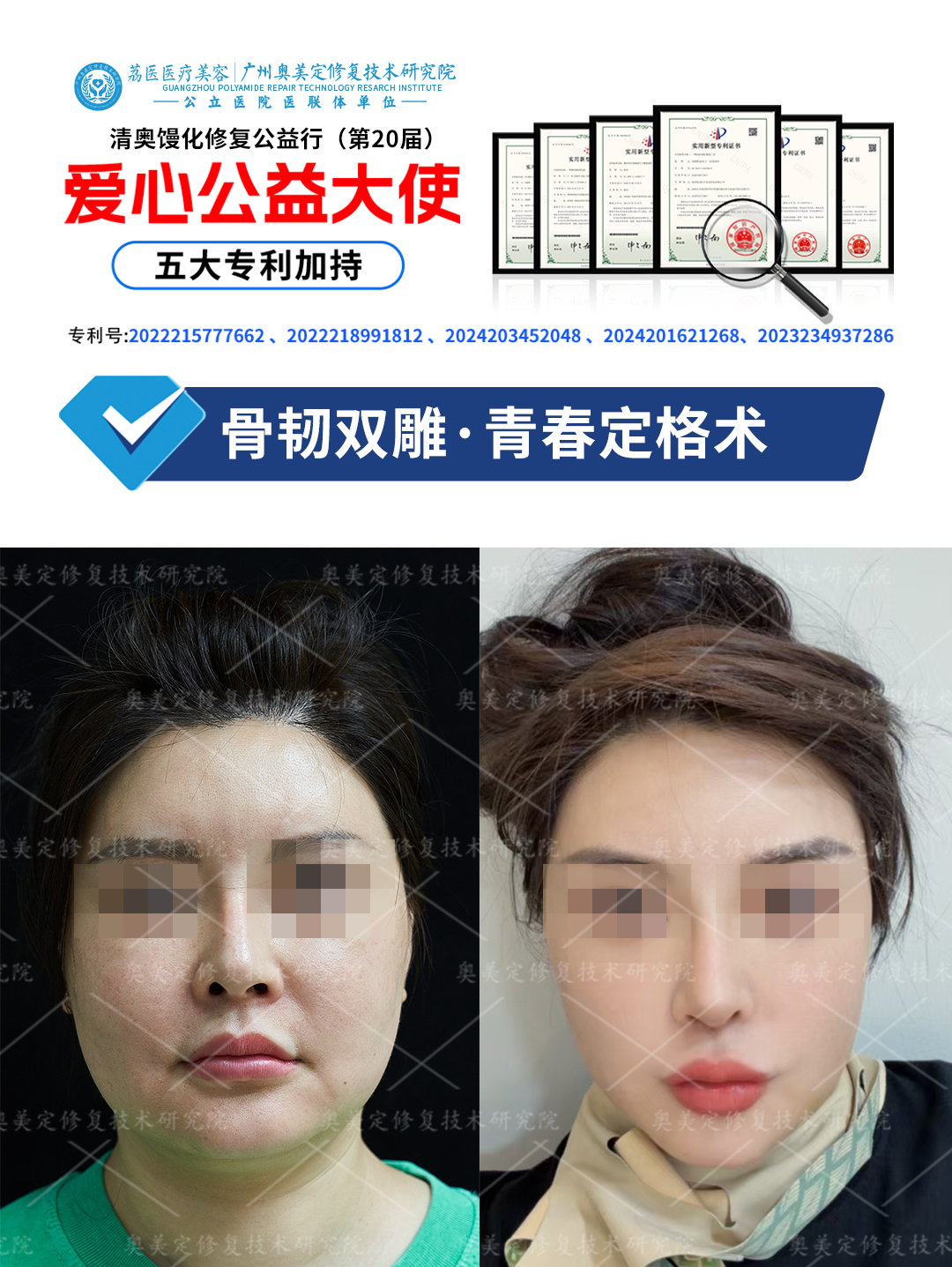 面部馒化后怎么修复