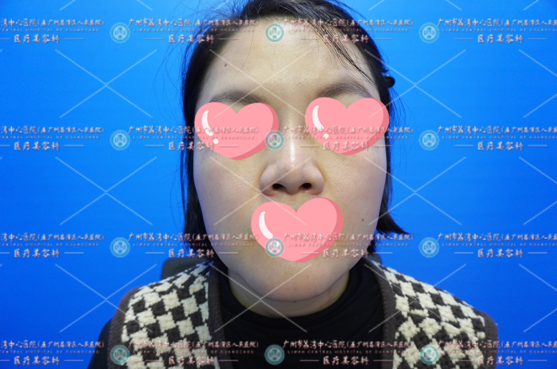 第17届关爱女性•清奥公益行圆满结束•生长因子要取出吗