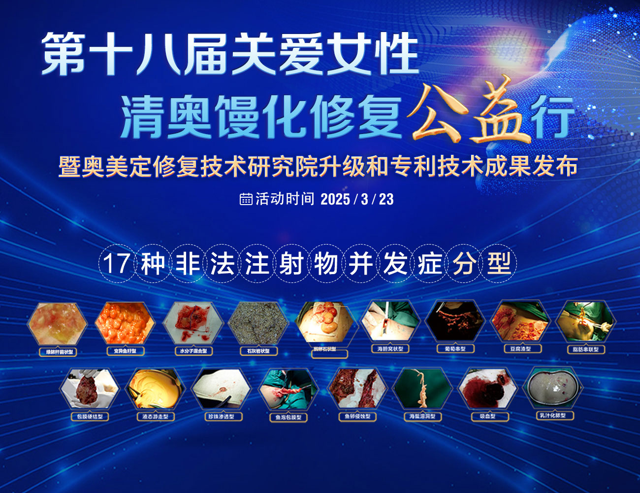 第十八届关爱女性清奥馒化修复公益行·生长因子如何取出