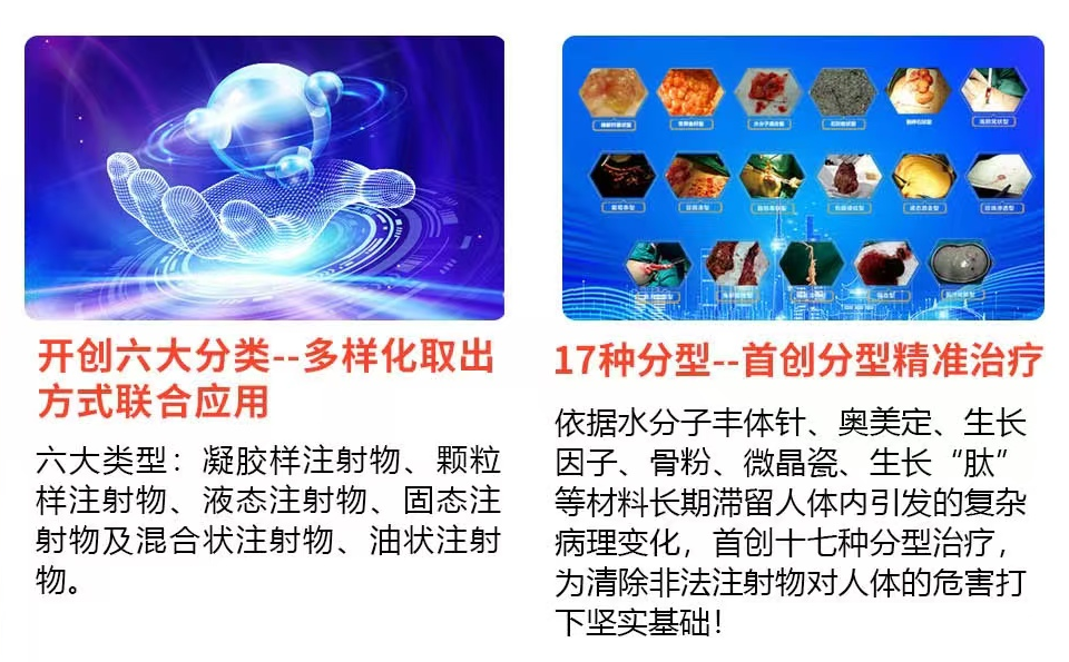 奥美定隆鼻后还能取出来吗？