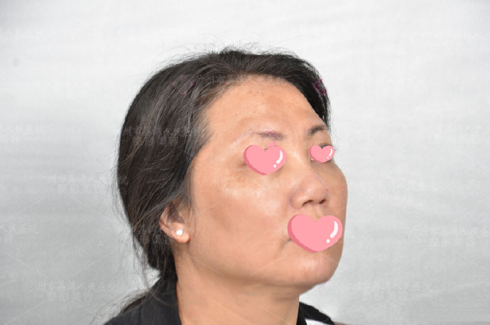 生长因子哪些部位特别难取