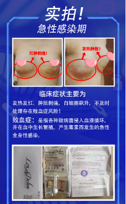 捷克水分子丰胸会不会有危害