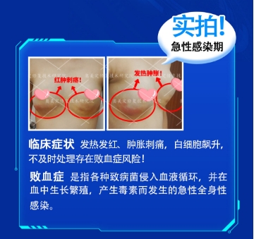 捷克水分子致癌是真的吗