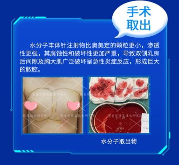 捷克水分子是奥美定吗