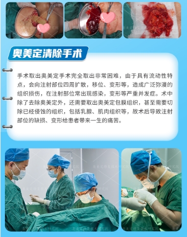 一次"透明凝胶"的奇幻旅程：患者捷克水分子取出实录