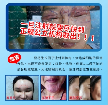 如何鉴定打的是不是生长因子